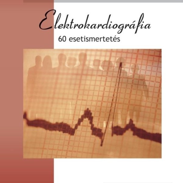ELEKTROKARDIOGRÁFIA - 60 ESETISMERTETÉS