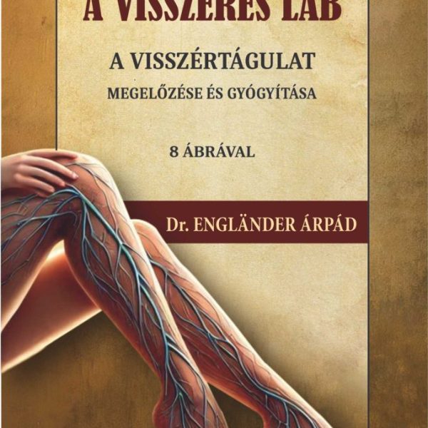 A VISSZERES LÁB -  A VISSZÉRTÁGULAT MEGELŐZÉSE ÉS GYÓGYÍTÁSA