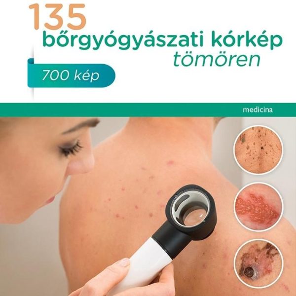 135 BŐRGYÓGYÁSZATI KÓRKÉP TÖMÖREN