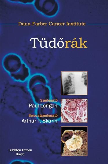 TÜDŐRÁK